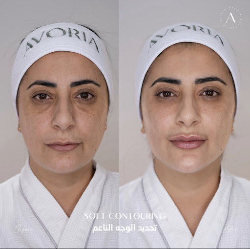 Avoria Aesthetic Clinic — BEAUTY in Dubai