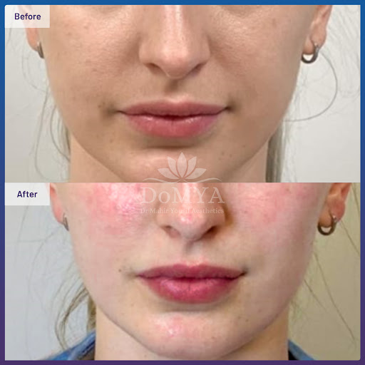 Dr Mahir Yousif Aesthetic Clinic — BEAUTY in Dubai — photo 3