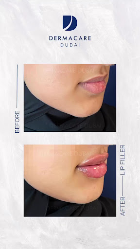 DERMACARE DUBAI — BEAUTY in Dubai — photo 3