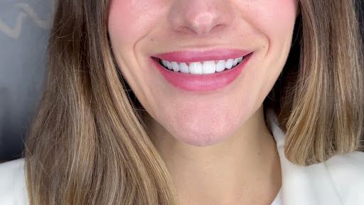 Prestige Smile Surge — BEAUTY in Dubai — photo 1
