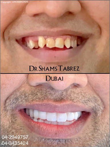 Crossroads Dental Clinic - Deira, Dubai — BEAUTY in Dubai — photo 3