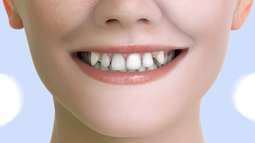 Crossroads Dental Clinic - Sheikh Zayed Road, Dubai — BEAUTY in Dubai — photo 2