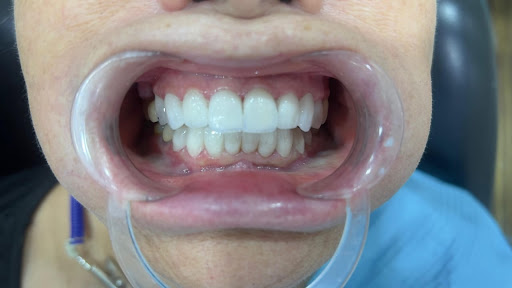 National Medical Center – GP | DENTAL | LONGEVITY | DERMA | IV — BEAUTY in Dubai