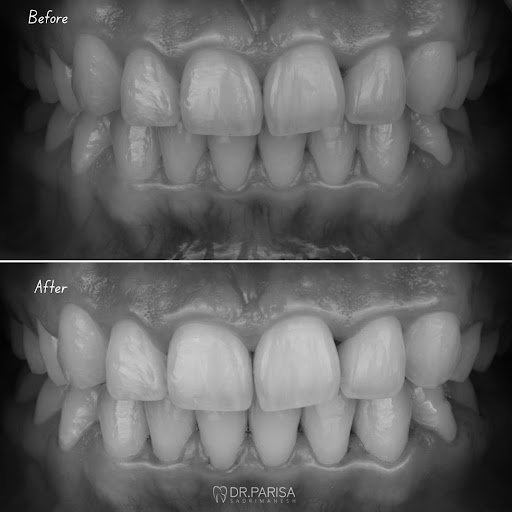 NOA Dental Clinic DMCC - JLT — BEAUTY in Dubai — photo 3