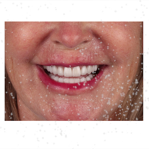 Hollywood Smile - ابتسامة هوليود — BEAUTY in Dubai — photo 3