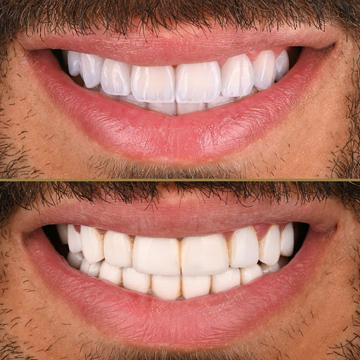 MyoSmile Polyclinic - Dental Clinic in Jumeirah — BEAUTY in Dubai — photo 2