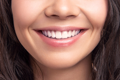 Versailles Dental Clinic — BEAUTY in Dubai — photo 2