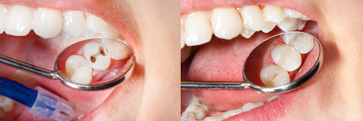 Versailles Dental Clinic — BEAUTY in Dubai — photo 3