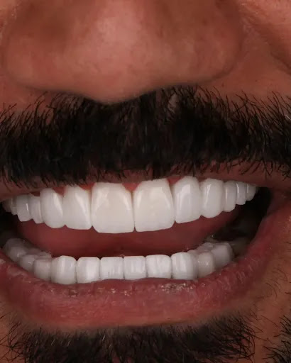 Bright Way Dental Clinic — BEAUTY in Dubai — photo 1