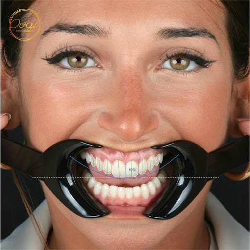 Oval Dental Clinic — BEAUTY in Dubai — photo 1