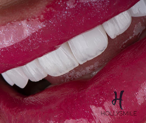 HollySmile Dubai By BeautifyMe — BEAUTY in Dubai — photo 3