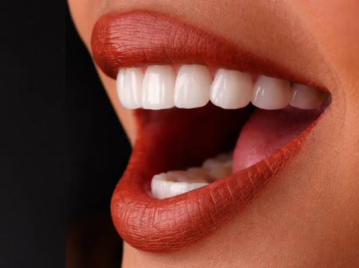 Bay Avenue Dental Centre, Orthodontist, Pediatric Dentist, Dental Implant Clinic Business Bay Dubai — BEAUTY in Dubai — photo 3