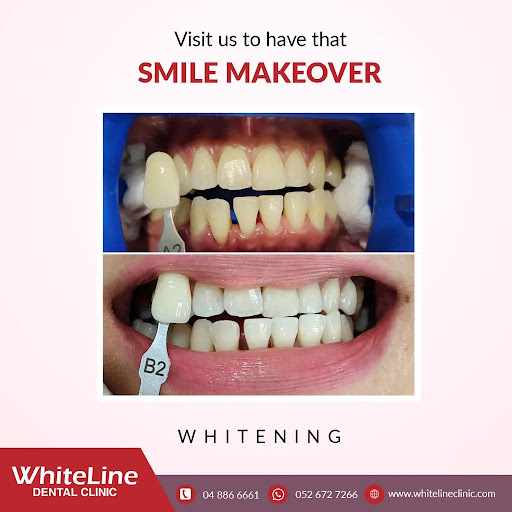 White Line Dental Clinic LLC — BEAUTY in Dubai — photo 3