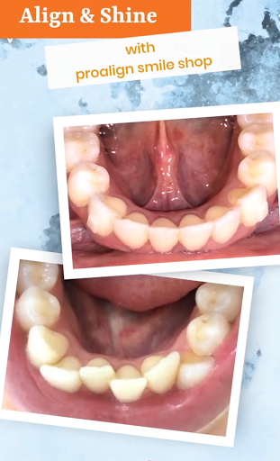 Proalign Smile Shop — BEAUTY in Dubai — photo 1