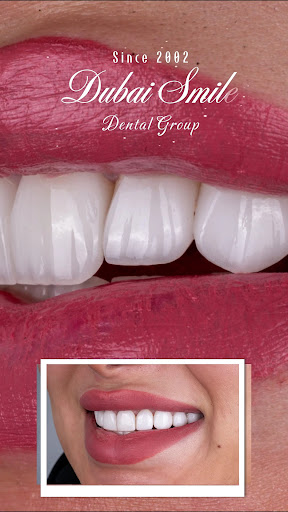 Dubai Smile Clinics | Dubai — BEAUTY in Dubai — photo 2