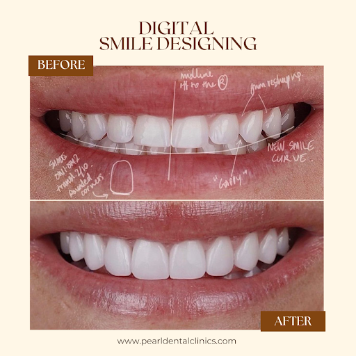 Pearl Dental Clinic - Business Bay — HEALTHCARE in Dubai — photo 3