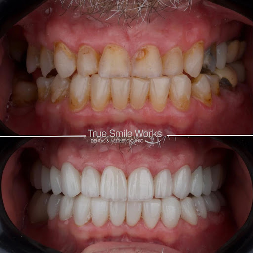 True Smile Works Dental & Aesthetic Clinics — HEALTHCARE in Dubai — photo 3