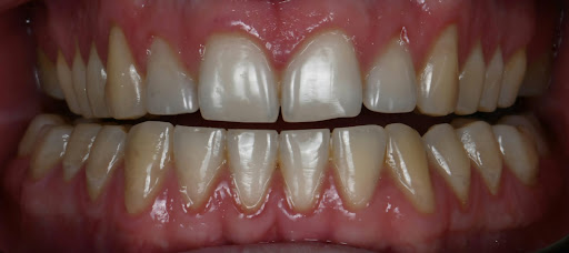 Dr Ajay Pala Implantologist — HEALTHCARE in Dubai — photo 3