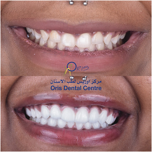 Oris Dental Center Jumeirah — HEALTHCARE in Dubai — photo 3