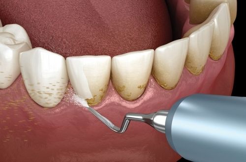 Al Abrah Clinic - Dental | Medical | Dermatology | Home healthcare — HEALTHCARE in Dubai — photo 3