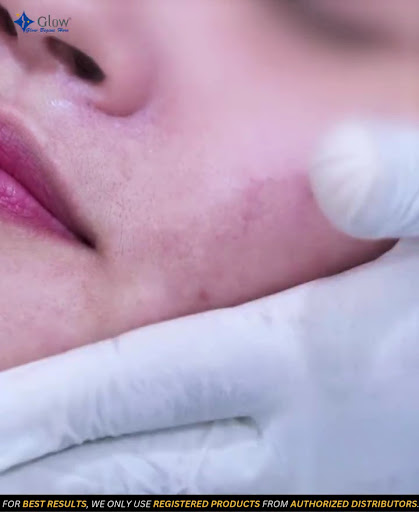 Glow Aesthetics Dermatology Clinic - Burjuman — HEALTHCARE in Dubai — photo 1