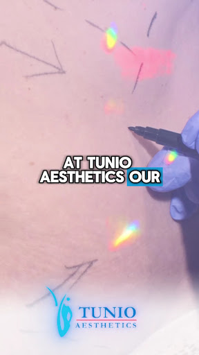 Tunio Aesthetics Hair Transplantation Clinic Dubai — HEALTHCARE in Dubai — photo 3