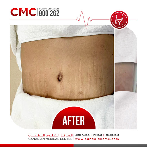 Canadian Medical Center and Plastic Surgery — HEALTHCARE in Dubai — photo 2