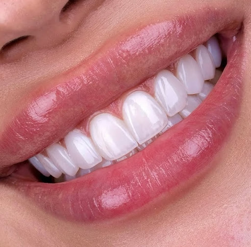 Versai Clinic – Dental, Dermatology & Laser | Dubai — HEALTHCARE in Dubai — photo 2