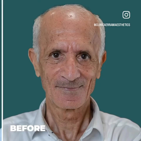 Clinica Errami - Aesthetic Clinic in Jumeirah | Medical Clinic in Jumeirah | Polyclinic in Dubai. | افضل عيادة تجميل في دبي — HEALTHCARE in Dubai — photo 1