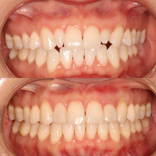 Dr Karan Kalra- Orthodontist in Dubai (Invisalign and braces Specialist) — HEALTHCARE in Dubai — photo 1